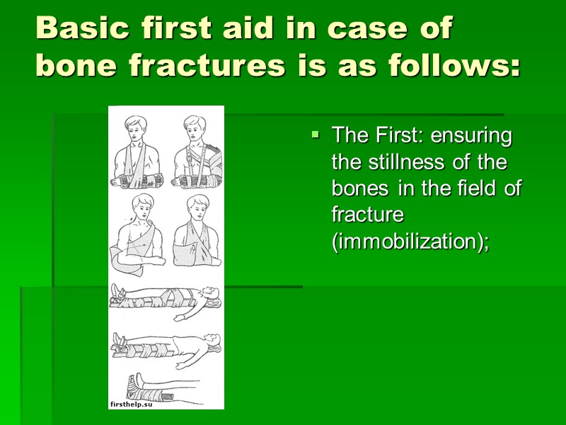 Basic first aid in case of bone fractures is as follows:  The First: